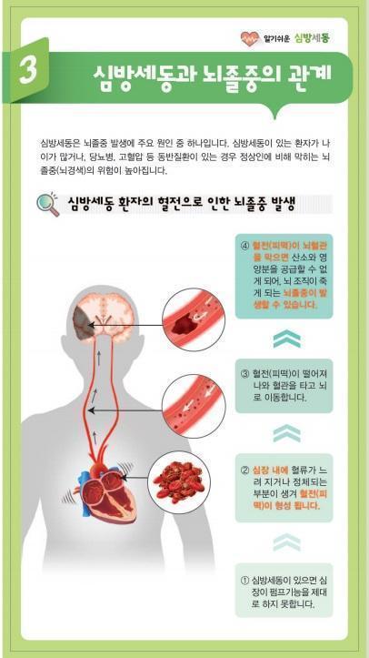  ▲ 심방세동과 뇌졸중의 관계./사진=원광대병원 전북권역심뇌혈관질환센터.   ⓒ익산투데이